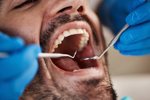 Best Broken Tooth Emergency  in Ames, IA